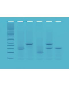 Edvotek DNA Fingerprinting Using PCR [0877]